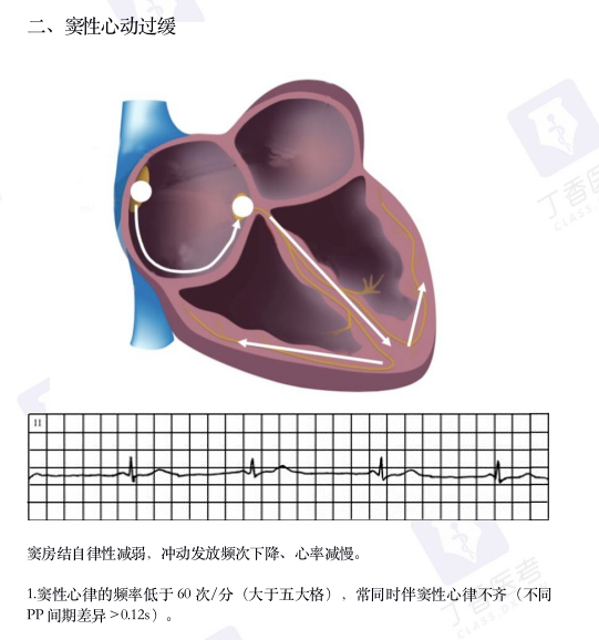 心电图纸怎么看考前突击：0 基础搞定心电图判读，看这一篇足够_https://www.jmylbn.com_新闻资讯_第6张