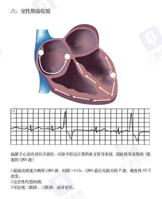 心电图纸怎么看考前突击：0 基础搞定心电图判读，看这一篇足够_https://www.jmylbn.com_新闻资讯_第10张