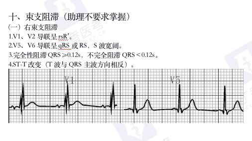 心电图纸怎么看考前突击：0 基础搞定心电图判读，看这一篇足够_https://www.jmylbn.com_新闻资讯_第16张