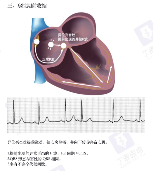 心电图纸怎么看考前突击：0 基础搞定心电图判读，看这一篇足够_https://www.jmylbn.com_新闻资讯_第7张