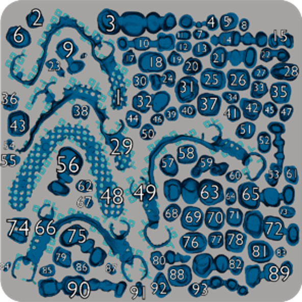 Oqton“0键” 24小时全自动3D打印产线排版，赋能数字化口腔正畸大生产的图7
