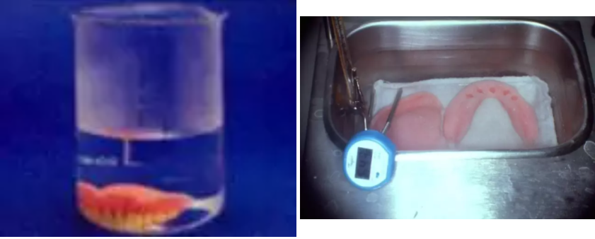 牙科材料硅胶怎么用软衬材料的应用及操作案例_https://www.jmylbn.com_新闻资讯_第13张