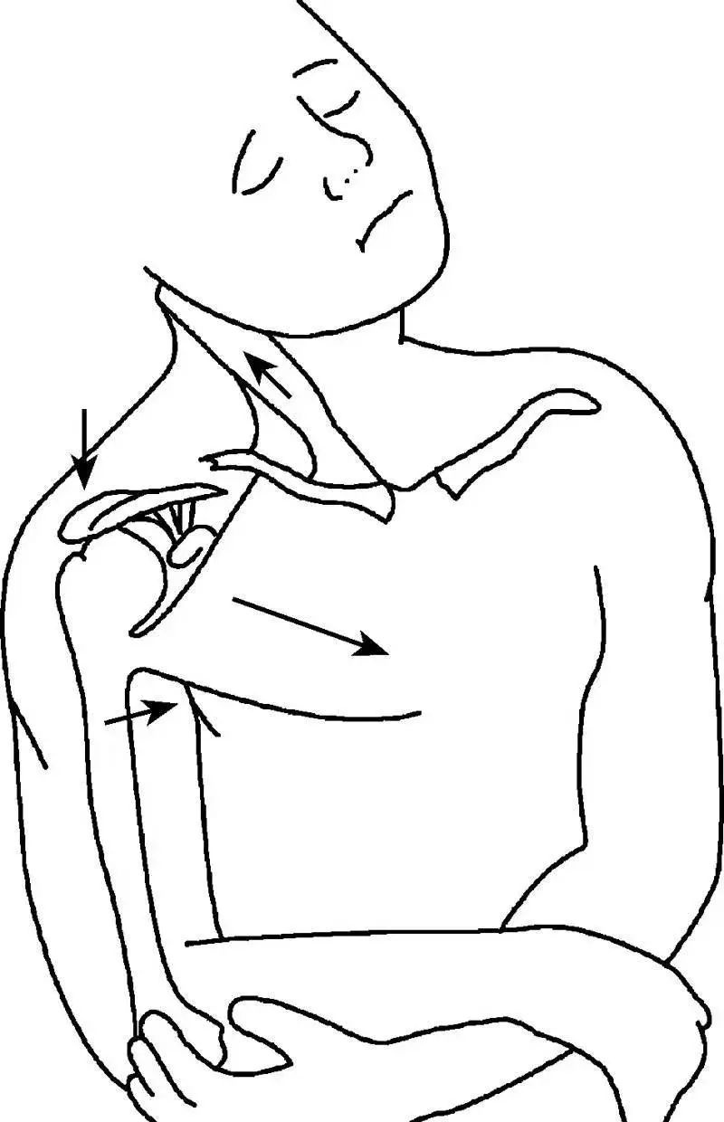 锁骨板有哪些【每周科普】锁骨骨折分中段、外段、内段，治疗方式也有差异_https://www.jmylbn.com_新闻资讯_第10张