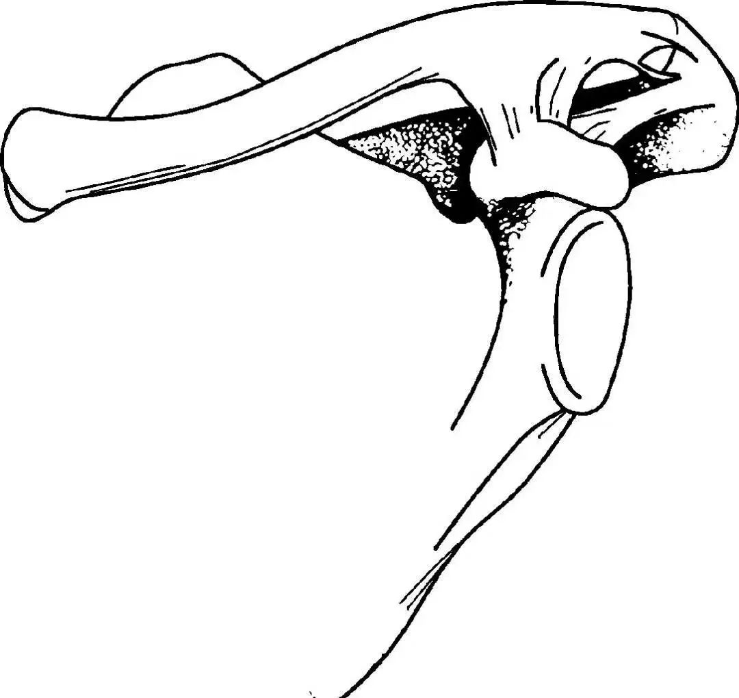 锁骨板有哪些【每周科普】锁骨骨折分中段、外段、内段，治疗方式也有差异_https://www.jmylbn.com_新闻资讯_第7张