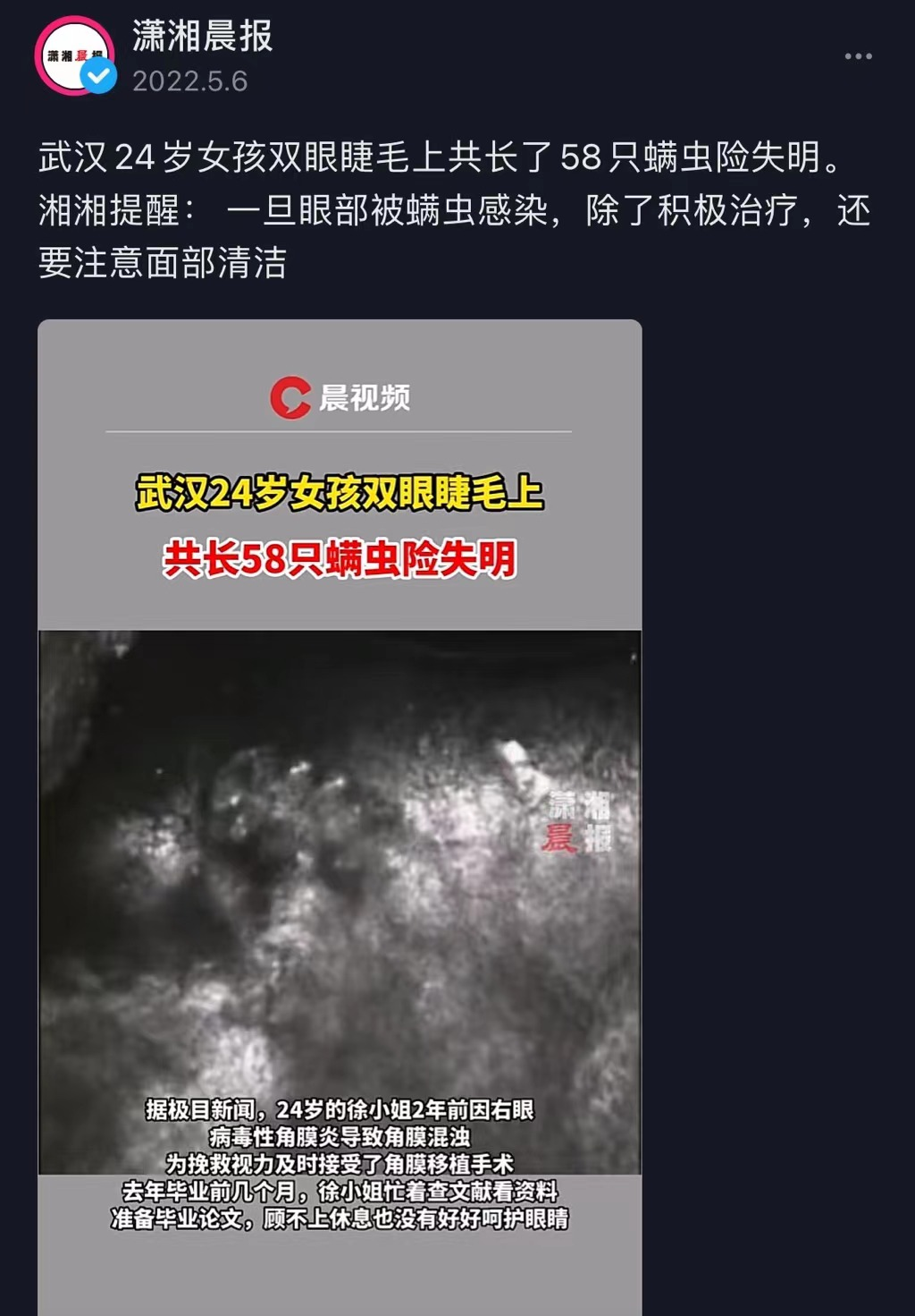 怎么判断是螨虫咬的包_螨虫咬人后症状图片_被子里的螨虫咬人吗