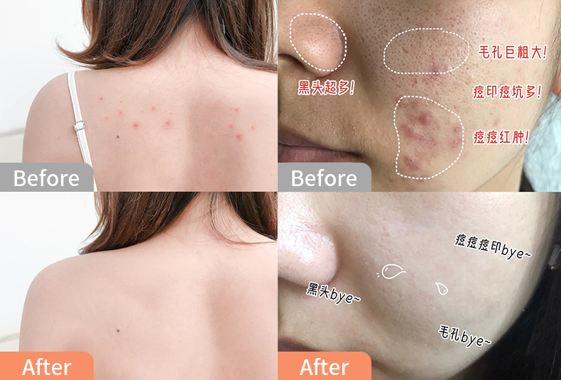 风油精孕妇闻了对胎儿有影响吗_孕妇风油精闻一个小时没事吧_孕妇闻了半小时风油精味道