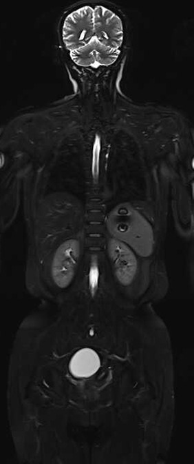 磁共振矩阵怎么计算精准医疗 影像先行 ｜ 河西学院附属张掖人民医院开启影像检查全新时代_https://www.jmylbn.com_新闻资讯_第13张