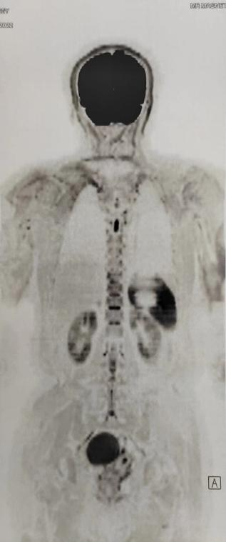 磁共振矩阵怎么计算精准医疗 影像先行 ｜ 河西学院附属张掖人民医院开启影像检查全新时代_https://www.jmylbn.com_新闻资讯_第12张