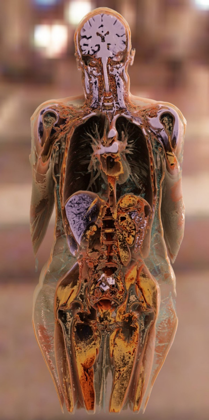 磁共振矩阵怎么计算精准医疗 影像先行 ｜ 河西学院附属张掖人民医院开启影像检查全新时代_https://www.jmylbn.com_新闻资讯_第8张