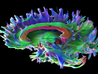 磁共振矩阵怎么计算精准医疗 影像先行 ｜ 河西学院附属张掖人民医院开启影像检查全新时代_https://www.jmylbn.com_新闻资讯_第7张