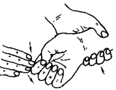 总结| 69条骨科试验名词! - 上海康定医疗器械有限公司