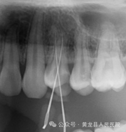 口腔ct怎么拍摄牙科CT拍片，让您手术安全有保障_https://www.jmylbn.com_新闻资讯_第7张