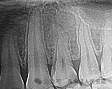 口腔ct怎么拍摄牙科CT拍片，让您手术安全有保障_https://www.jmylbn.com_新闻资讯_第6张