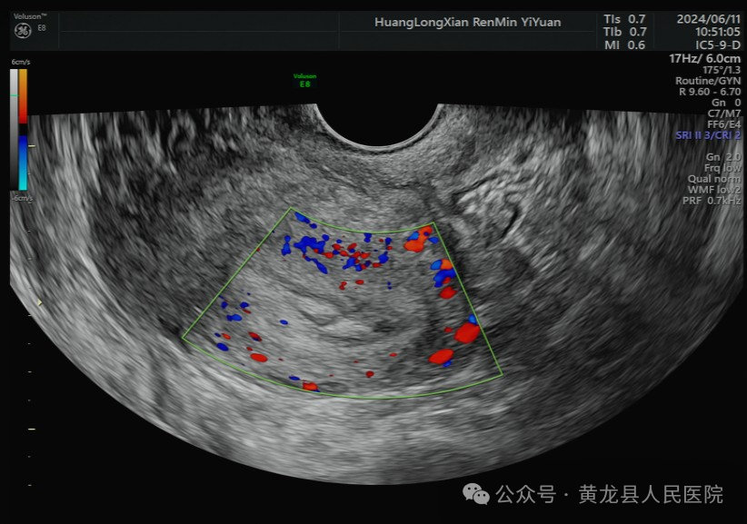 VOlusonE什么彩超机超声科GE Voluson E8四维彩超诊断仪，为女性健康护航！_https://www.jmylbn.com_新闻资讯_第2张