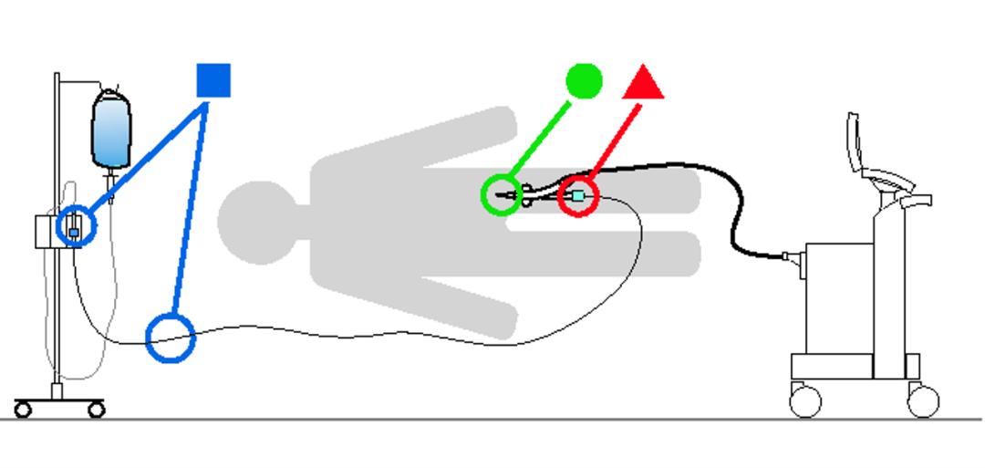 clearcuff加压袋为什么ICU知识小科普系列之IABP_https://www.jmylbn.com_新闻资讯_第3张