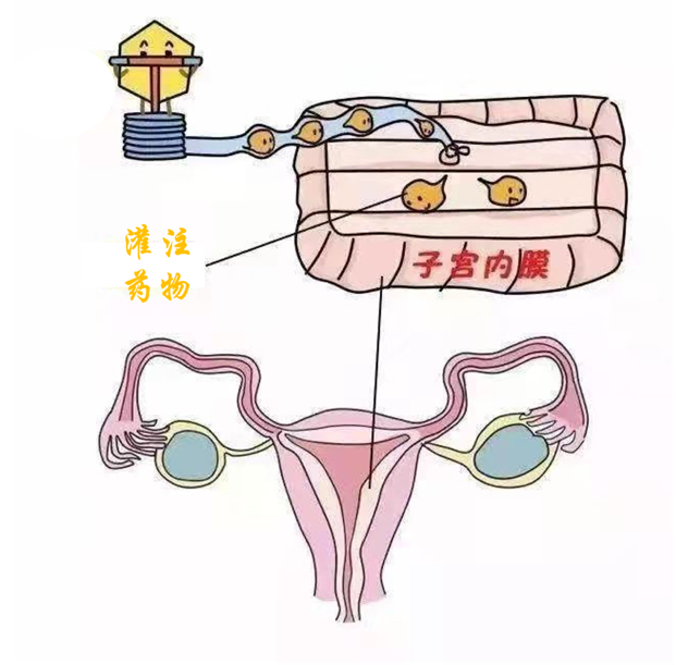 妇科蛋白膜怎么用重组Ⅲ型人源化胶原蛋白——薄型子宫内膜的希望之星_https://www.jmylbn.com_新闻资讯_第6张