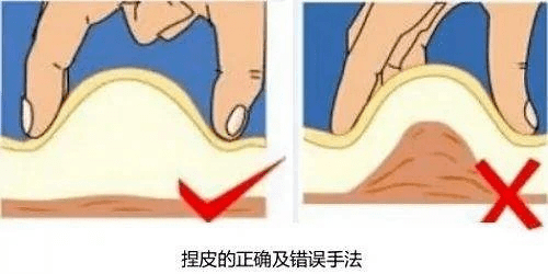 打肝素怎么拔针肝素自行注射指导攻略_https://www.jmylbn.com_新闻资讯_第6张