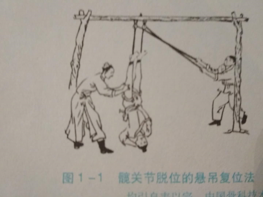 康复悬吊组装怎么装康复科的几根绳子——SET悬吊技术_https://www.jmylbn.com_新闻资讯_第6张