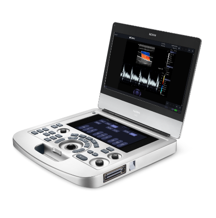 索诺星超声怎么样索诺星和理邦全新彩超机器_https://www.jmylbn.com_新闻资讯_第40张