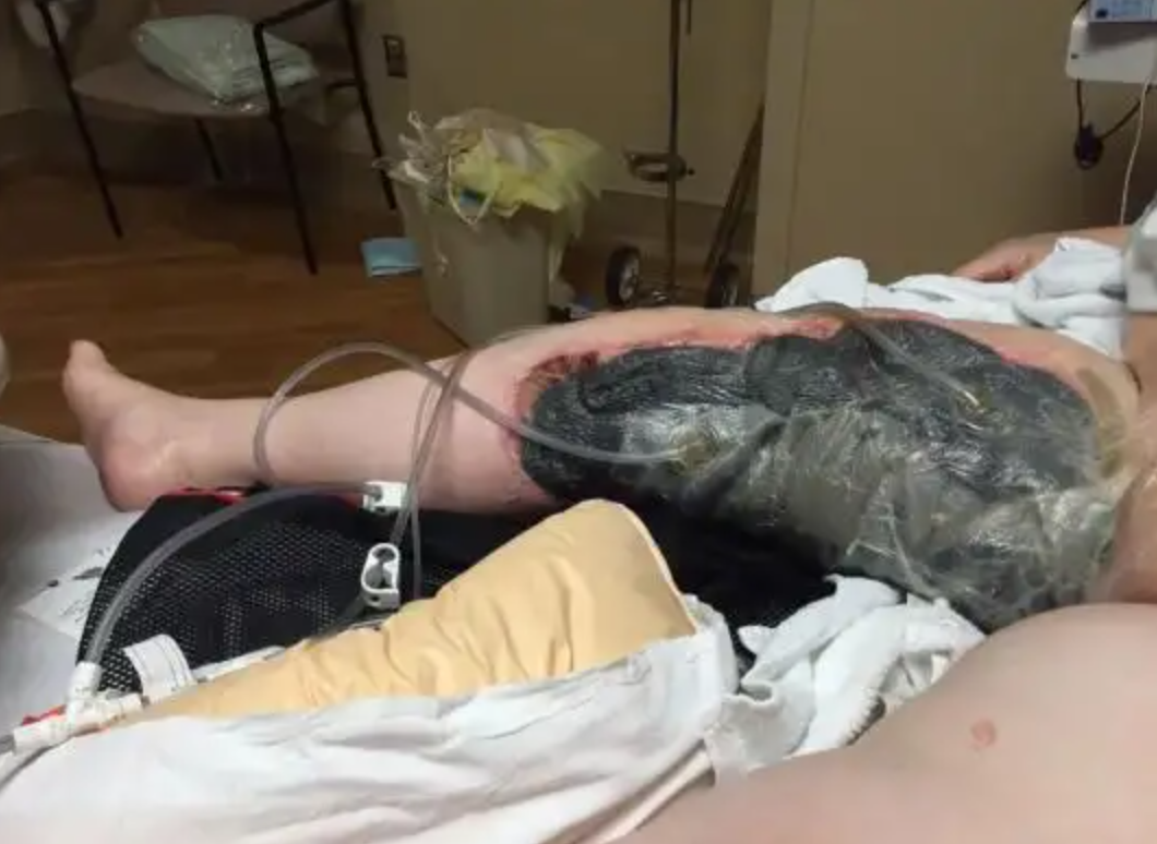 红掌的风水寓意_红掌风水摆放禁忌_红掌风水大忌