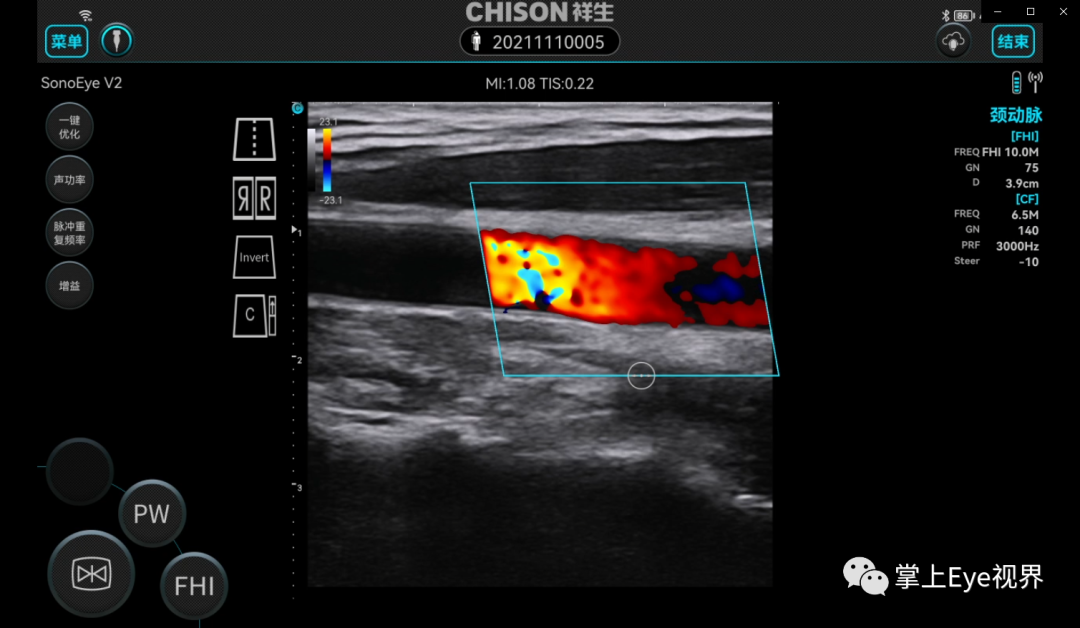 彩超伪像是什么超声基础 ｜ 超声伪像_https://www.jmylbn.com_新闻资讯_第4张
