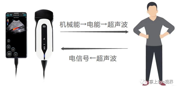 凸阵探头包括哪些超声基础 ｜ 探头的构造及工作原理_https://www.jmylbn.com_新闻资讯_第13张