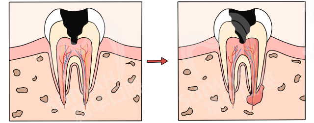 2019-12-14配图-
牙结构2.png