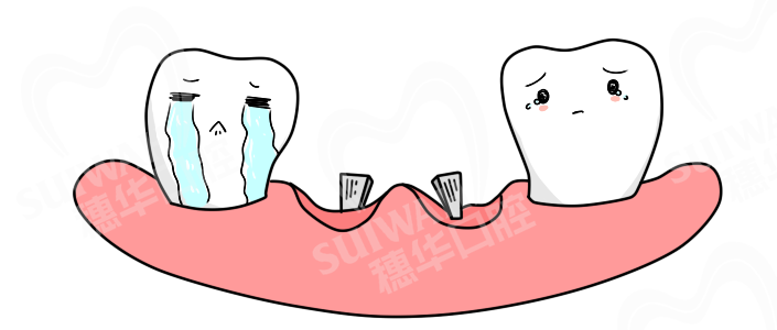 2019-10-22头-种植-
缺牙1.png