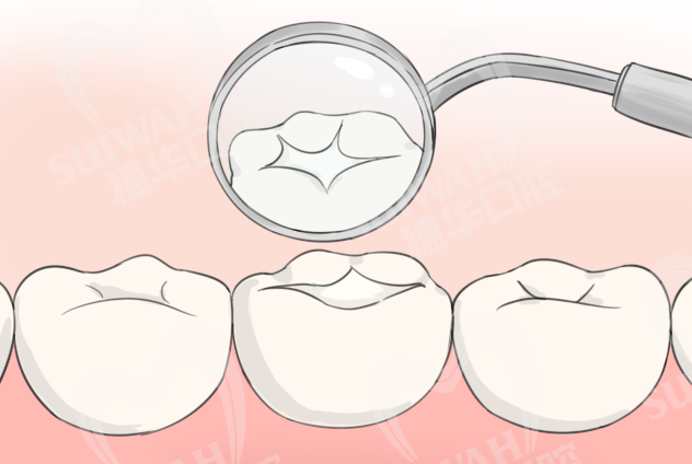 2023-4-4条漫-
玻璃离子.png