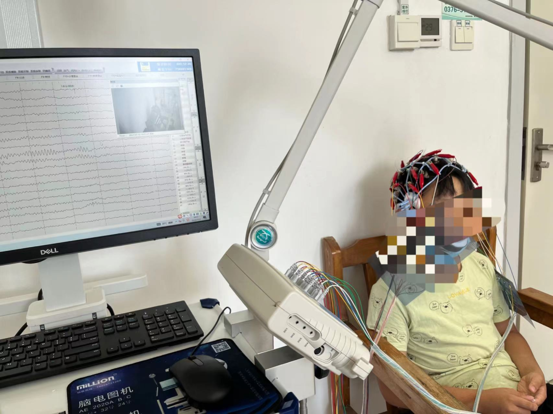 16导脑电图怎么放置长程多导视频脑电图准确捕捉“异常波”的蛛丝马迹 ----- 潢川县人民医院服务能力提升系列报道_https://www.jmylbn.com_新闻资讯_第5张