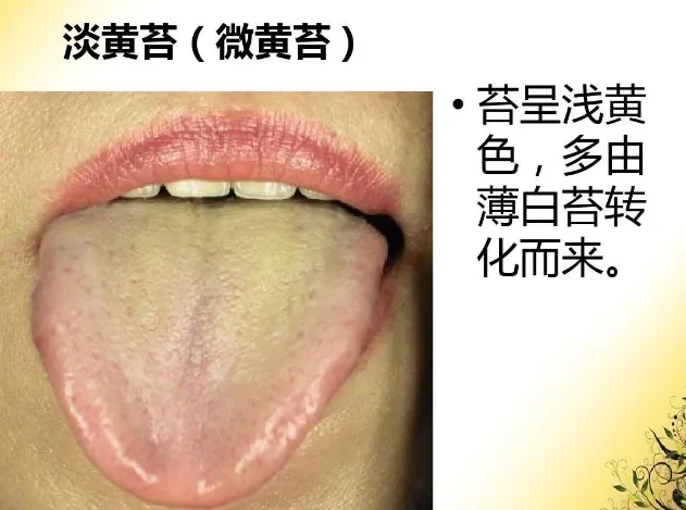 望诊之全息舌诊脉诊辩研修班