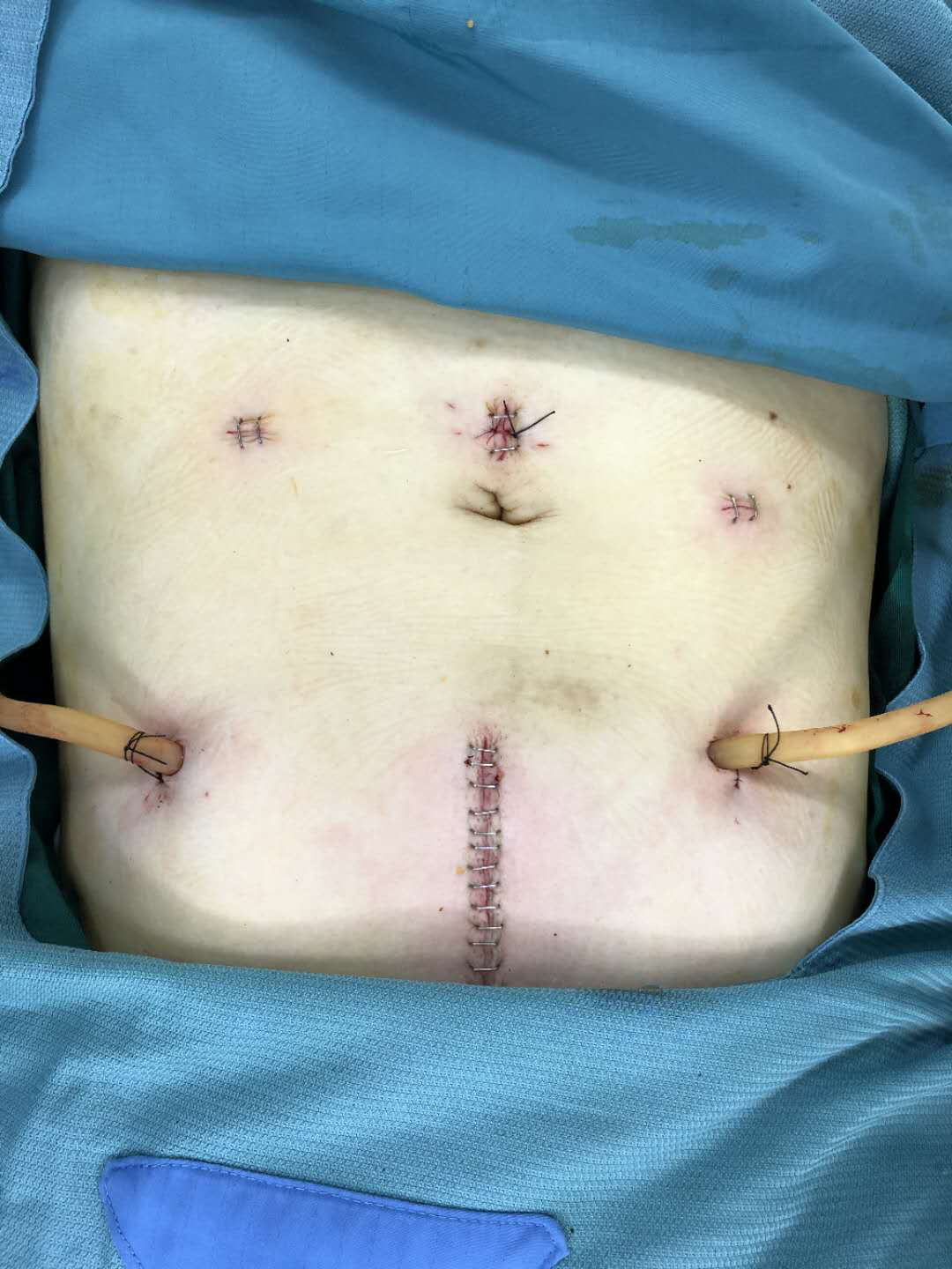 为什么要用皮钉缝合科普电台｜你听过钉皮机吗？_https://www.jmylbn.com_新闻资讯_第6张