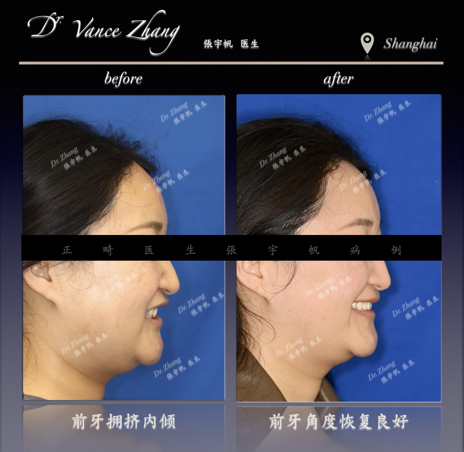 深覆合的健康隐患正式病例贴图6