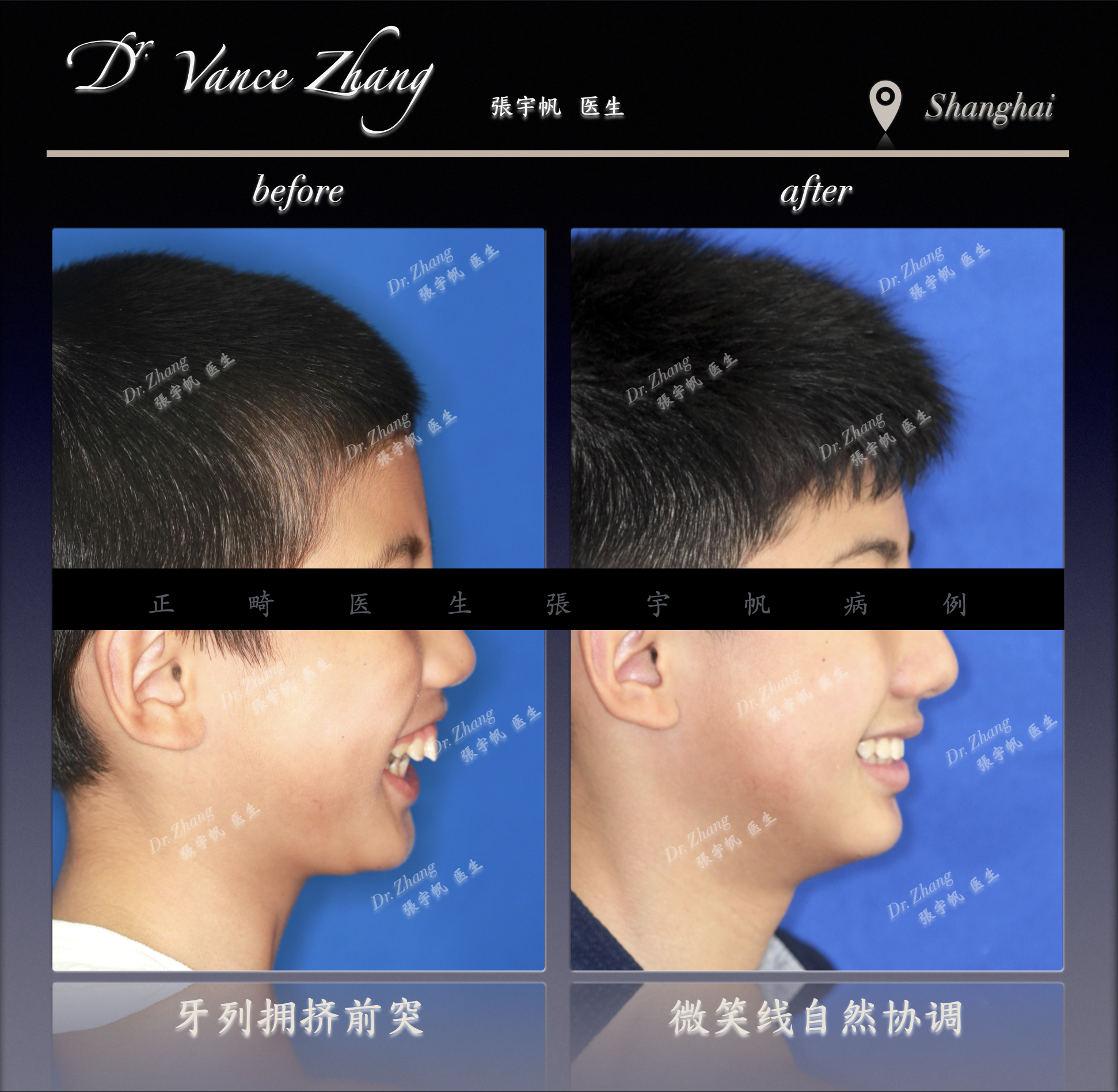 颜面发育管理的意义正式病例贴图6