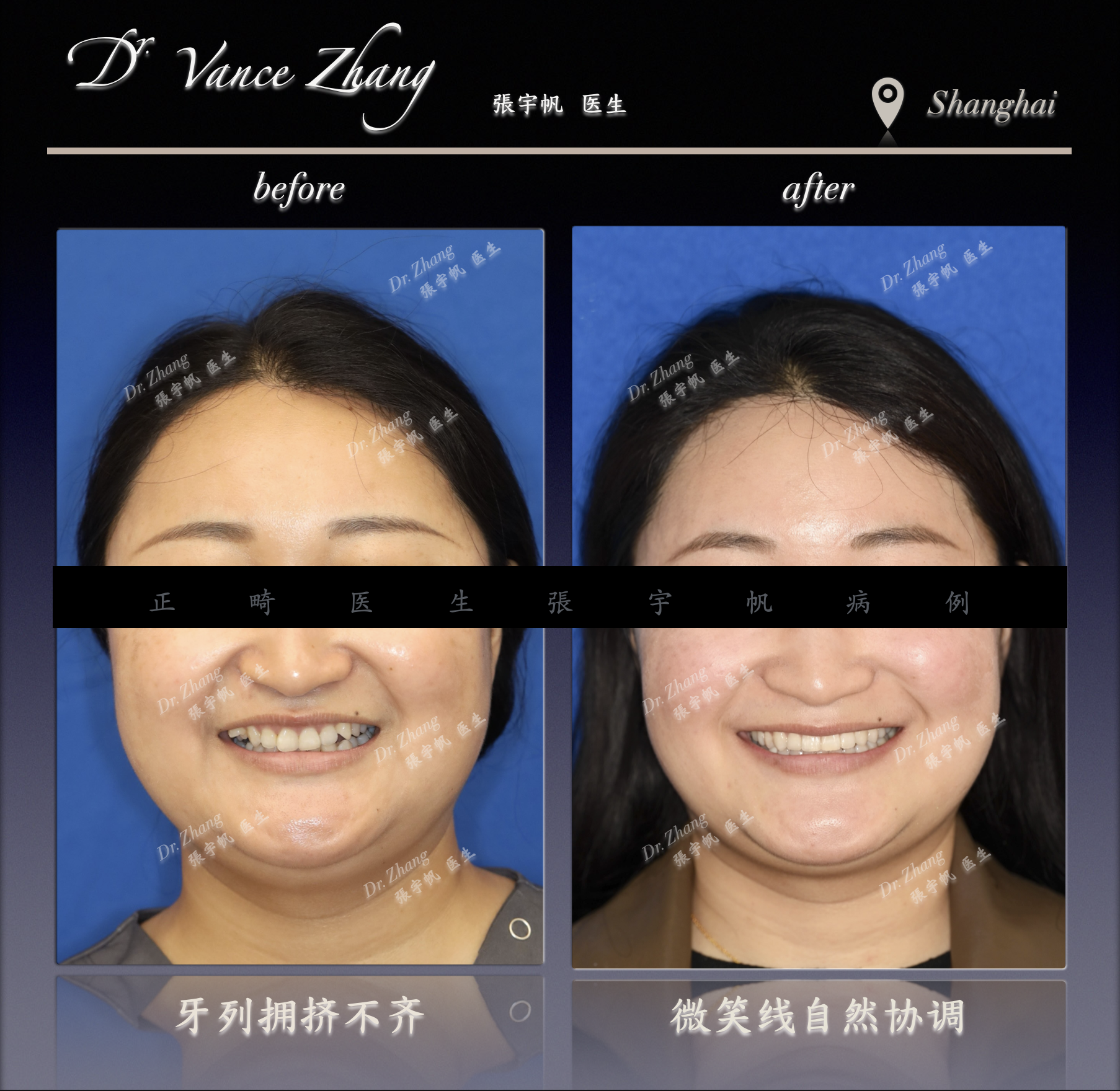 深覆合的健康隐患正式病例贴图3