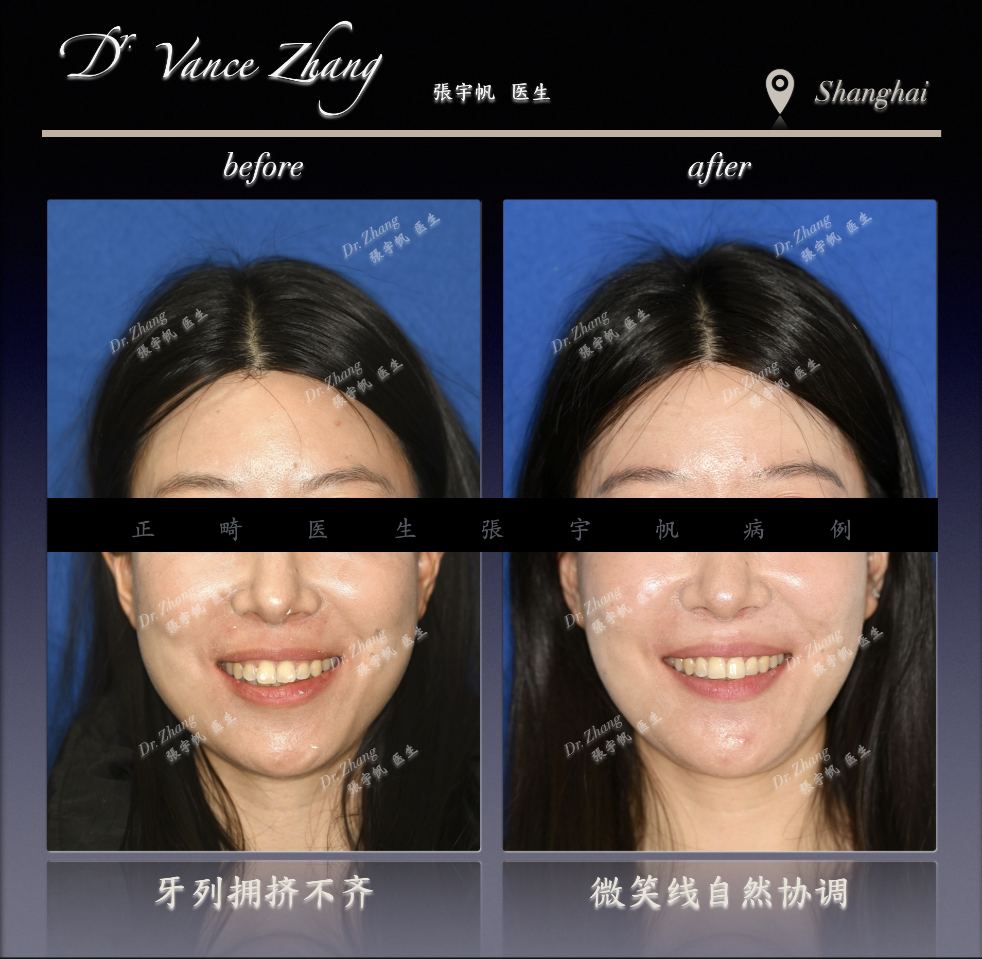 远移磨牙的临床意义正式病例贴图3
