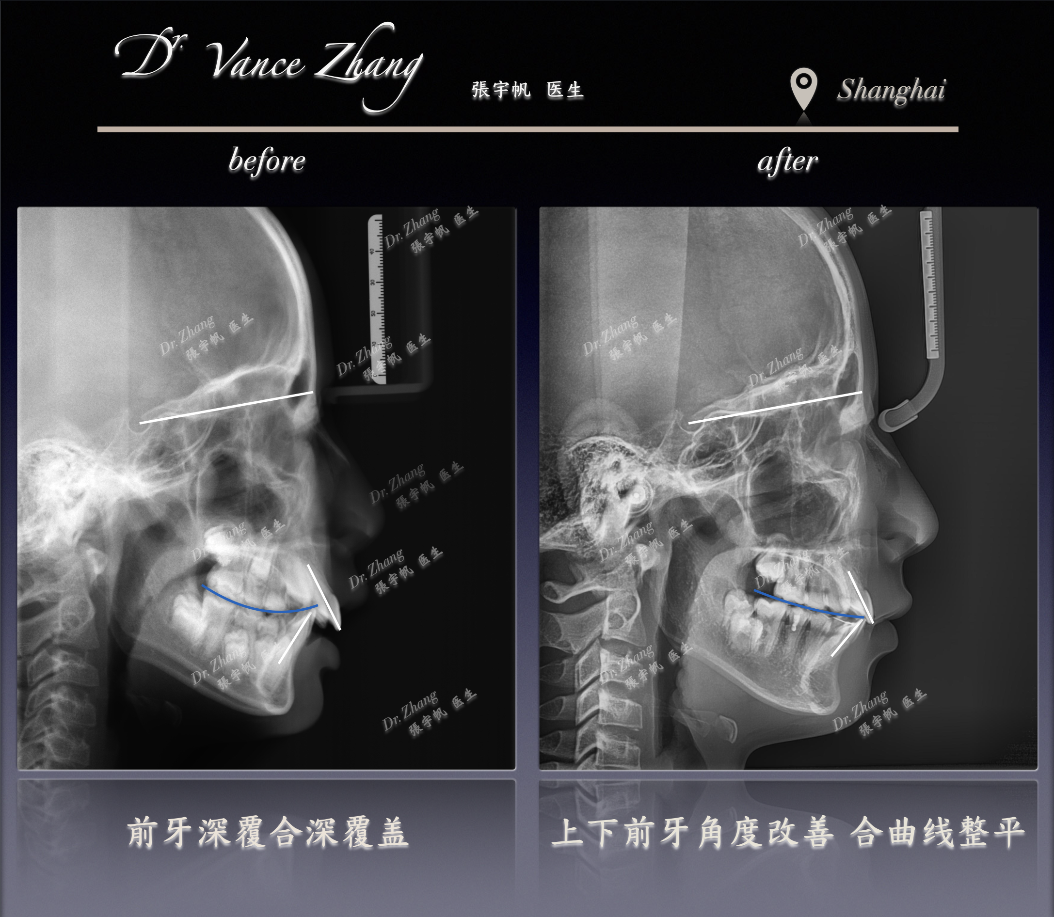 颜面发育管理的意义正式病例贴图15