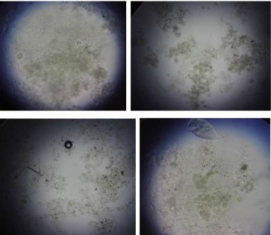 活性污泥镜检图片