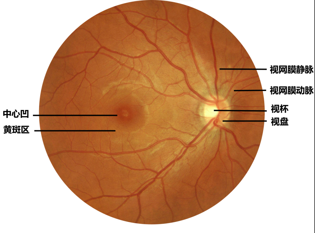 眼底照相能检查出什么眼底咔嚓拍张照 健康问题早知道_https://www.jmylbn.com_新闻资讯_第4张