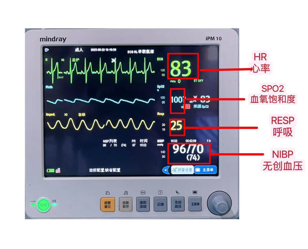 心电监护仪怎么测血压心电监护仪的操作及注意事项，详细又实用【视频+PPT】_https://www.jmylbn.com_新闻资讯_第4张