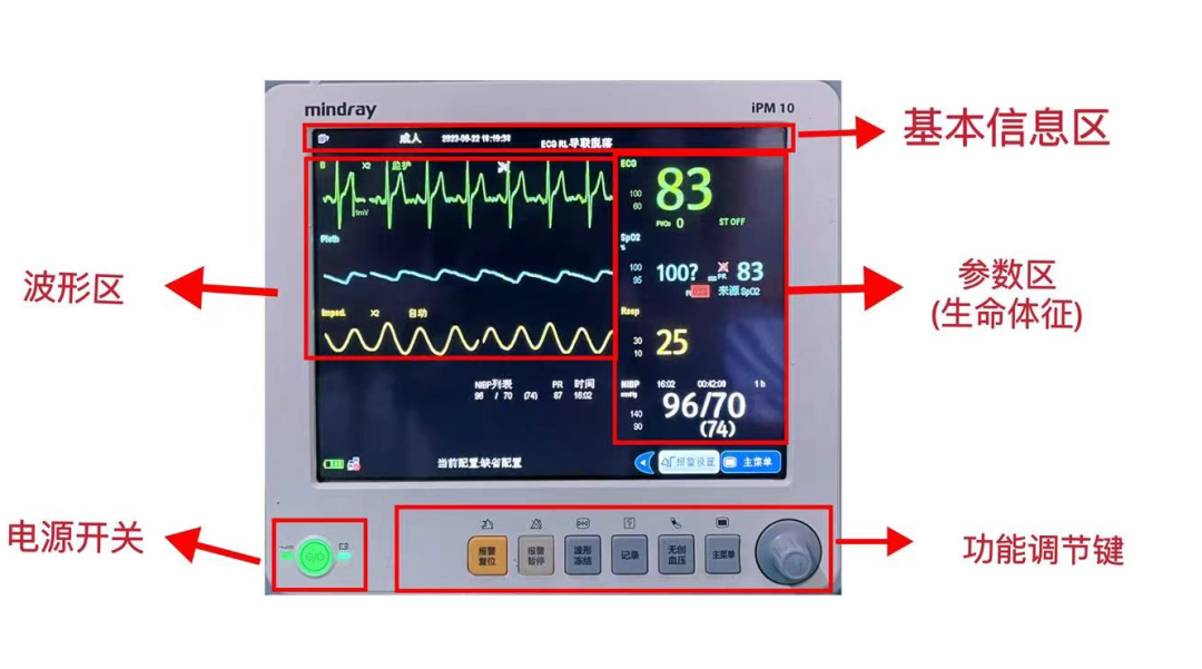 心电监护仪怎么测血压心电监护仪的操作及注意事项，详细又实用【视频+PPT】_https://www.jmylbn.com_新闻资讯_第3张