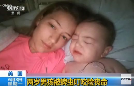 杀人怪病重现美国？17岁少年被虫子咬了一口，连命都没了！（组图） - 1