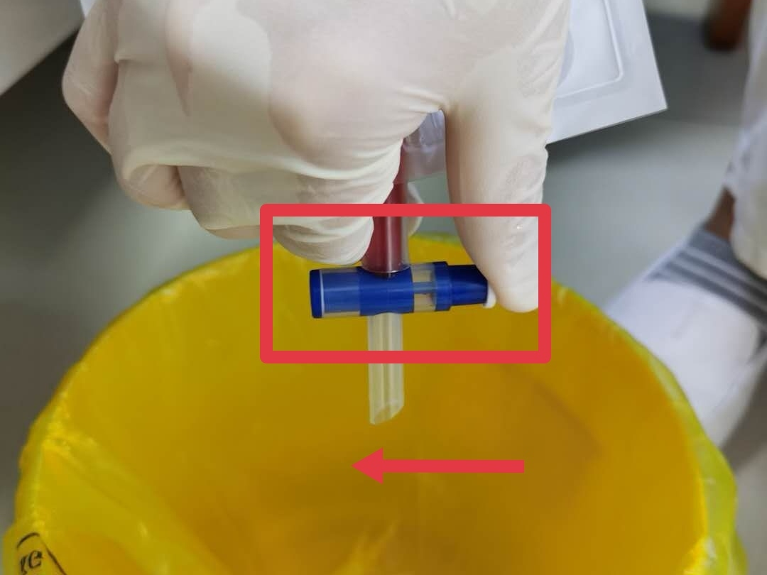 伤口引流袋怎么用保“管”学会——乳腺癌术后带管居家护理_https://www.jmylbn.com_新闻资讯_第16张