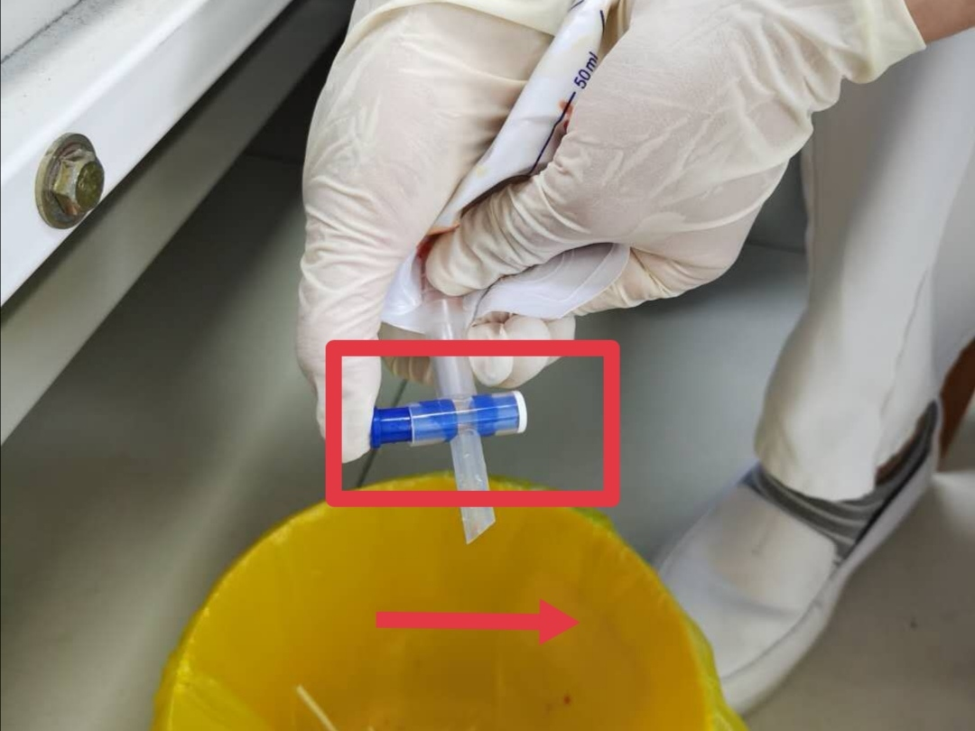 伤口引流袋怎么用保“管”学会——乳腺癌术后带管居家护理_https://www.jmylbn.com_新闻资讯_第17张