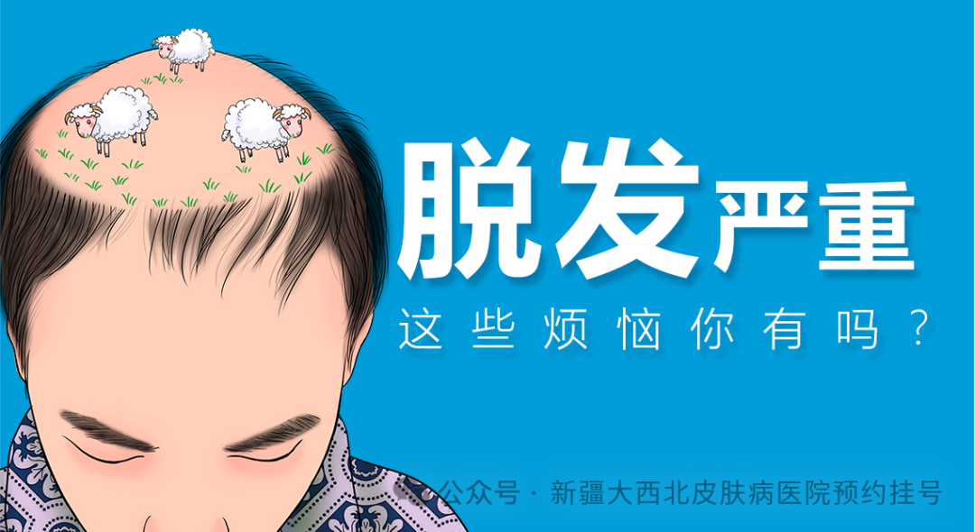 突然大量脱发，越来越严重了怎么办？新疆治疗脱发的好医院