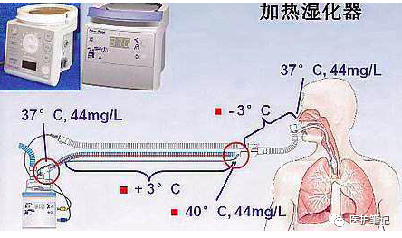 人工鼻怎么使用人工鼻的应用和护理，一文读懂！_https://www.jmylbn.com_新闻资讯_第5张
