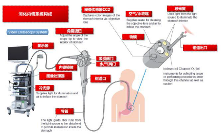 宾得胃镜怎么样深度 ｜ 一次性内窥镜，几百亿的蓝海市场，“谁主沉浮”_https://www.jmylbn.com_新闻资讯_第6张