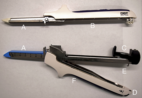 肠道吻合器是什么材质超级干货 ｜ 专家指导：胃肠吻合术使用线型吻合器的六大步骤_https://www.jmylbn.com_新闻资讯_第3张