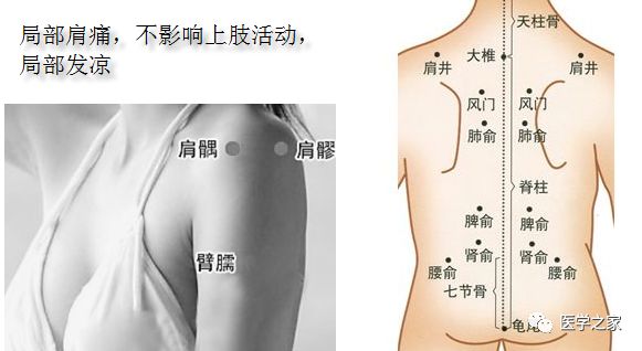 针灸肩周炎