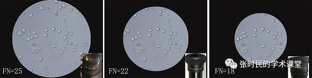 尿沉渣仪器怎么使用关于尿常规，所有检验人必须关注的N个复检要点！_https://www.jmylbn.com_新闻资讯_第5张